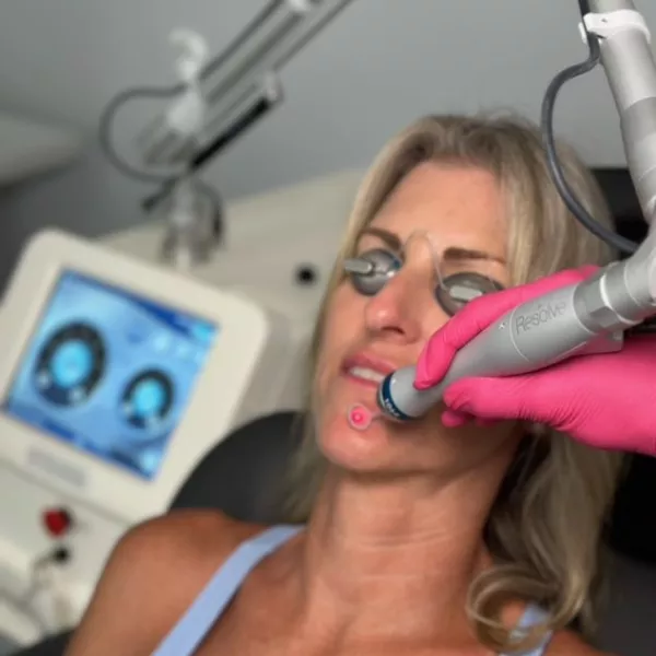 Laser facial treatment at Vanity Compound