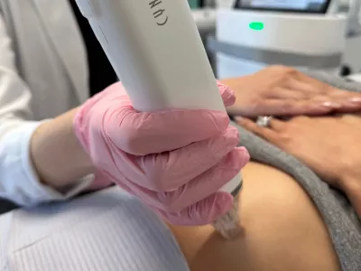 RF microneedling treatment at Vanity Compound